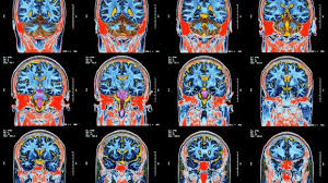 deep learning in medical imaging